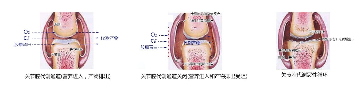 恶性循环电脑图.jpg